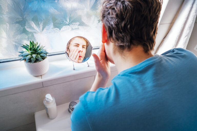 Acne Filter Effect EFFECTS OF ACNE: MORE THAN SKIN DEEP – Youth Connections Coalition